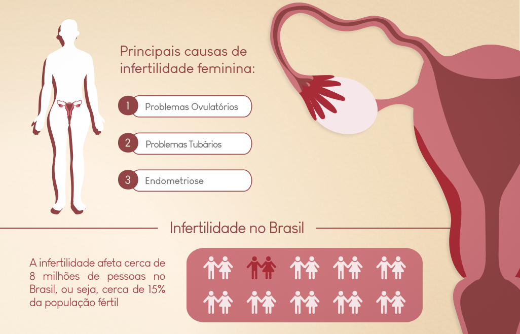 Principais causas de infertilidade feminina
